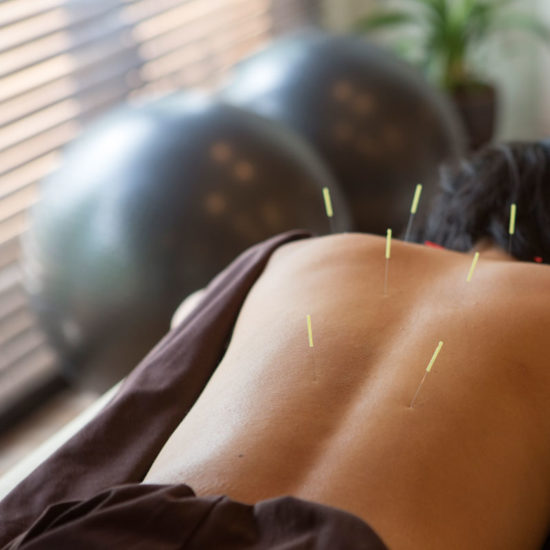 acupuncture-101