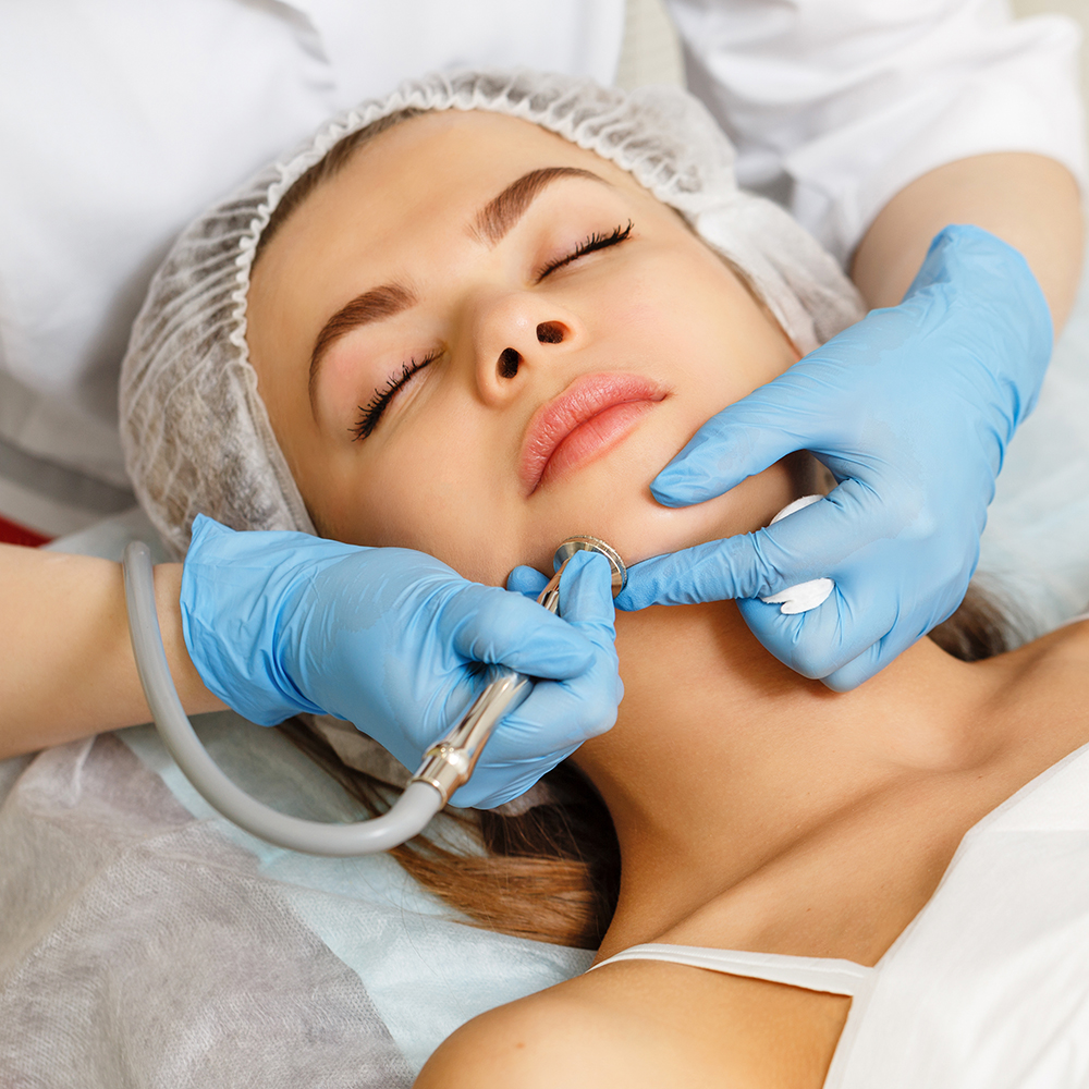 Find microdermabrasion near me