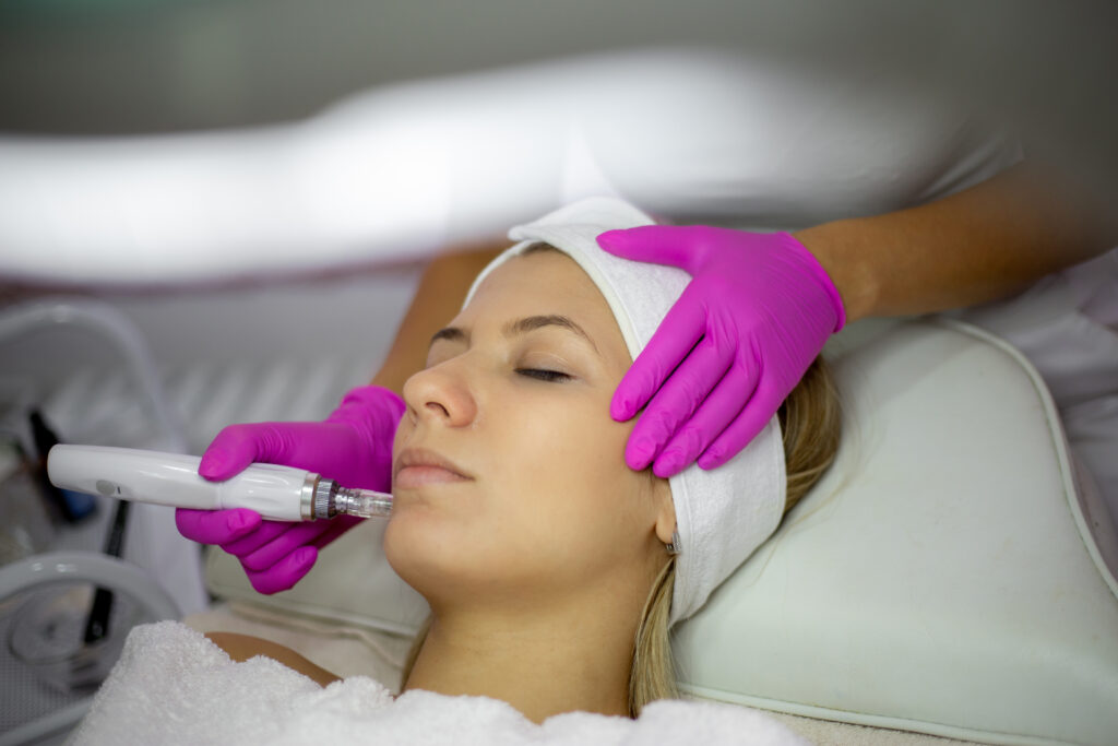 microneedling