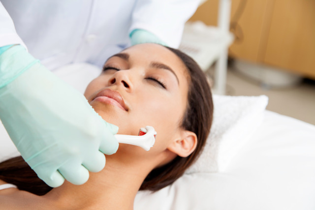 Microneedling